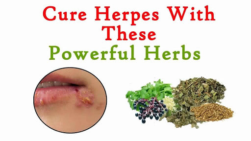 
            
                Load image into Gallery viewer, Herpes Relief Herbal Blend (HSV Cleanse)
            
        